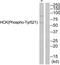 HCK Proto-Oncogene, Src Family Tyrosine Kinase antibody, TA313123, Origene, Western Blot image 