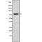 Luteinizing Hormone/Choriogonadotropin Receptor antibody, abx216416, Abbexa, Western Blot image 