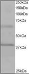 Ankyrin Repeat And BTB Domain Containing 1 antibody, orb88757, Biorbyt, Western Blot image 