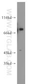 DEAD-Box Helicase 51 antibody, 20149-1-AP, Proteintech Group, Western Blot image 