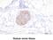 Ubiquitin C-Terminal Hydrolase L1 antibody, MBS200060, MyBioSource, Immunohistochemistry frozen image 