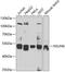 NOP2/Sun RNA Methyltransferase 6 antibody, GTX33369, GeneTex, Western Blot image 