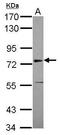 Set1/Ash2 histone methyltransferase complex subunit ASH2 antibody, PA5-30298, Invitrogen Antibodies, Western Blot image 