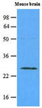 RAB5A, Member RAS Oncogene Family antibody, LS-C93791, Lifespan Biosciences, Western Blot image 