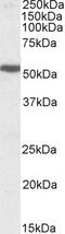 Integrin Subunit Alpha L antibody, 42-769, ProSci, Western Blot image 