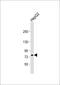 ATP Binding Cassette Subfamily G Member 1 antibody, A01227-1, Boster Biological Technology, Western Blot image 