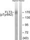 Fms Related Tyrosine Kinase 3 antibody, PA5-37580, Invitrogen Antibodies, Western Blot image 