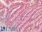 Peroxiredoxin 1 antibody, LS-B3966, Lifespan Biosciences, Immunohistochemistry paraffin image 