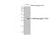 Cytotoxic T-Lymphocyte Associated Protein 4 antibody, GTX134527, GeneTex, Western Blot image 
