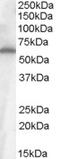 Frizzled Class Receptor 4 antibody, LS-C61739, Lifespan Biosciences, Western Blot image 