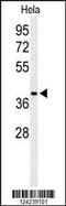 Poly(ADP-ribose) glycohydrolase ARH3 antibody, 64-080, ProSci, Western Blot image 