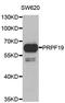 Pre-MRNA Processing Factor 19 antibody, A6706, ABclonal Technology, Western Blot image 