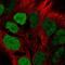 T-cell acute lymphocytic leukemia protein 1 antibody, NBP2-56907, Novus Biologicals, Immunofluorescence image 