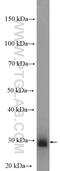 Potassium Voltage-Gated Channel Interacting Protein 4 antibody, 13748-1-AP, Proteintech Group, Western Blot image 