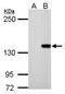 DNA Methyltransferase 3 Beta antibody, PA5-32218, Invitrogen Antibodies, Western Blot image 