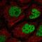 Chromosome 2 Open Reading Frame 49 antibody, HPA060814, Atlas Antibodies, Immunofluorescence image 