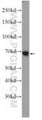 N-acetylmuramoyl-L-alanine amidase antibody, 23029-1-AP, Proteintech Group, Western Blot image 