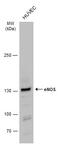 Nitric Oxide Synthase 3 antibody, GTX129843, GeneTex, Western Blot image 