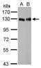 Lipin 1 antibody, GTX115676, GeneTex, Western Blot image 