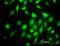 Rap Guanine Nucleotide Exchange Factor 6 antibody, orb95212, Biorbyt, Immunofluorescence image 