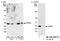 Protein Phosphatase 6 Catalytic Subunit antibody, NB100-2883, Novus Biologicals, Western Blot image 