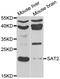 Spermidine/Spermine N1-Acetyltransferase Family Member 2 antibody, orb373571, Biorbyt, Western Blot image 
