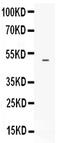 Endothelin Receptor Type B antibody, PB9554, Boster Biological Technology, Western Blot image 