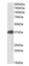 Forkhead Box F1 antibody, orb154563, Biorbyt, Western Blot image 