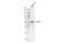 Cytochrome P450 Family 17 Subfamily A Member 1 antibody, 17334S, Cell Signaling Technology, Western Blot image 