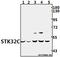 Serine/Threonine Kinase 32C antibody, A13378, Boster Biological Technology, Western Blot image 