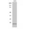 Eukaryotic Translation Initiation Factor 5A2 antibody, LS-C383310, Lifespan Biosciences, Western Blot image 