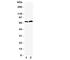 Peptidyl Arginine Deiminase 4 antibody, R31153, NSJ Bioreagents, Western Blot image 