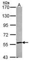 Cytochrome P450 Family 2 Subfamily A Member 6 antibody, GTX103360, GeneTex, Western Blot image 