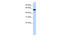 Polypyrimidine Tract Binding Protein 1 antibody, 25-608, ProSci, Western Blot image 