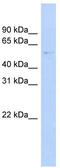 Growth Arrest Specific 8 antibody, TA346497, Origene, Western Blot image 