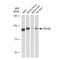 Signal Transducer And Activator Of Transcription 5B antibody, GTX08967, GeneTex, Western Blot image 