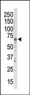 G Protein-Coupled Receptor Kinase 5 antibody, TA324891, Origene, Western Blot image 