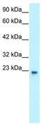 General Transcription Factor IIF Subunit 2 antibody, TA329283, Origene, Western Blot image 