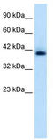 HEXIM P-TEFb Complex Subunit 1 antibody, TA335686, Origene, Western Blot image 