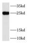 Ras-related protein Rab-3A antibody, FNab07024, FineTest, Western Blot image 