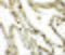 TSN antibody, 6369, ProSci Inc, Immunohistochemistry paraffin image 