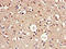 AP2 Associated Kinase 1 antibody, LS-C500941, Lifespan Biosciences, Immunohistochemistry frozen image 