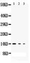 Interleukin 3 antibody, PA1728, Boster Biological Technology, Western Blot image 