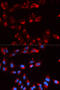 Complement Factor Properdin antibody, 19-638, ProSci, Immunofluorescence image 