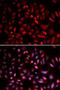 Protein Kinase CAMP-Activated Catalytic Subunit Beta antibody, LS-C333984, Lifespan Biosciences, Immunofluorescence image 
