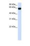 Phosphatidylinositol Glycan Anchor Biosynthesis Class T antibody, NBP1-69642, Novus Biologicals, Western Blot image 