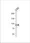 Matrilin 2 antibody, TA325076, Origene, Western Blot image 