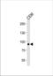 Matrilin-2 antibody, TA325076, Origene, Western Blot image 