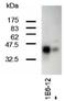TAL BHLH Transcription Factor 1, Erythroid Differentiation Factor antibody, NBP2-50285, Novus Biologicals, Western Blot image 