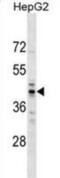 TRNA Methyltransferase 10A antibody, abx029820, Abbexa, Western Blot image 